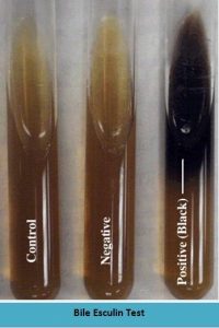 Bile Esculin Test Results: Control, Positive and Negative  - Bile esculin test results: Control, Positive and Negative
