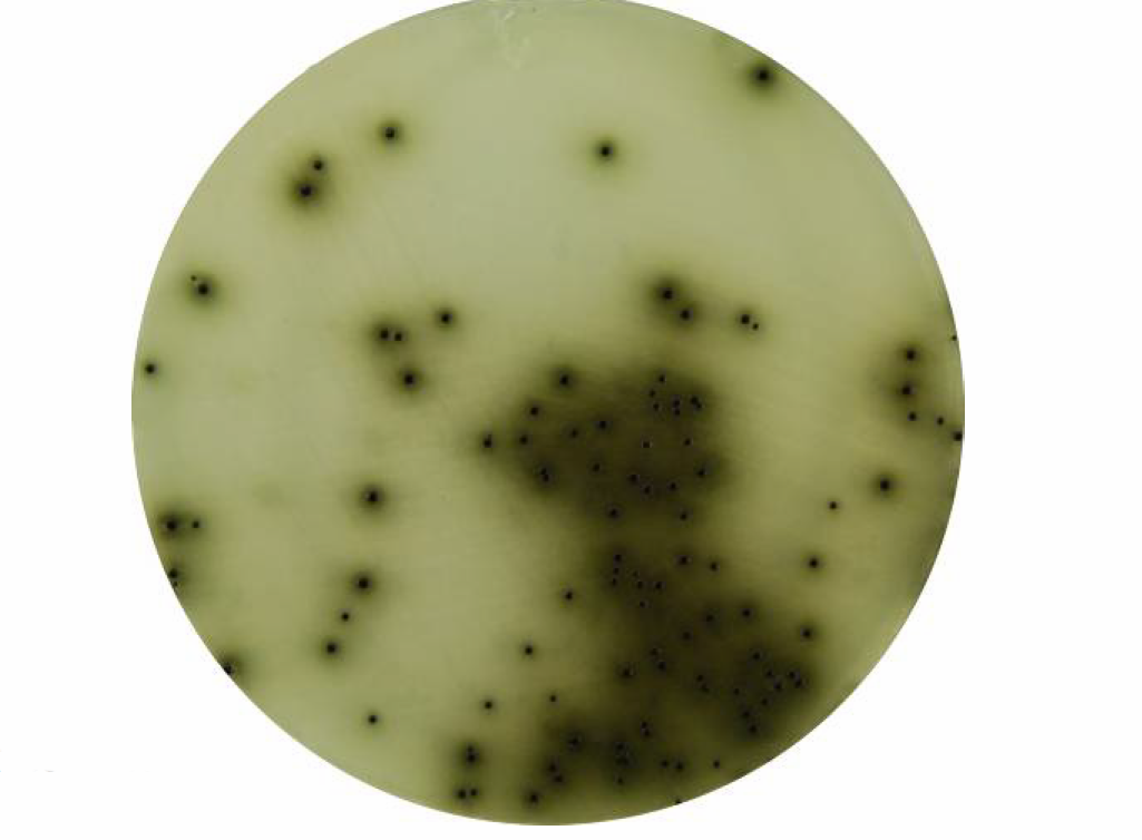 Bismuth Sulfite Agar - Bismuth Sulfite Agar