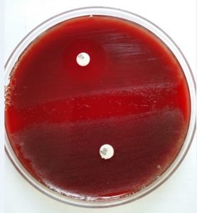 Optochin and Bacitracin Sensitivity of the isolates in Blood Agar - Optochin and bacitracin sensitivity of the isolates in Blood agar