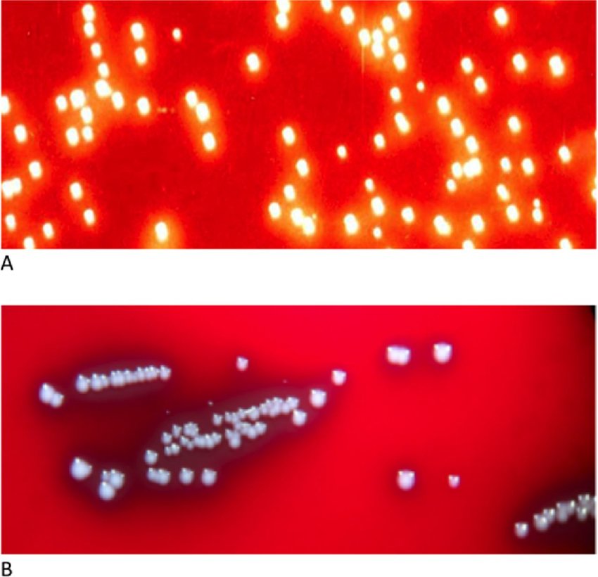 Bordetella pertussis (A) and B. parapertussis (B) grown on Bordet and Gengos medium. - Bordetella pertussis(A) andB. parapertussis(B) grown on Bordet and Gengos medium. (Image source: Ref-5)