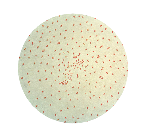  - Gram negativeBordetella pertussis(Image source: CDC)
