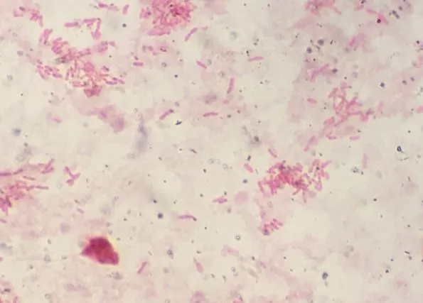  - B. pseudomalleiin Gram-stain (image source-Ian Martin, idmic-net).
