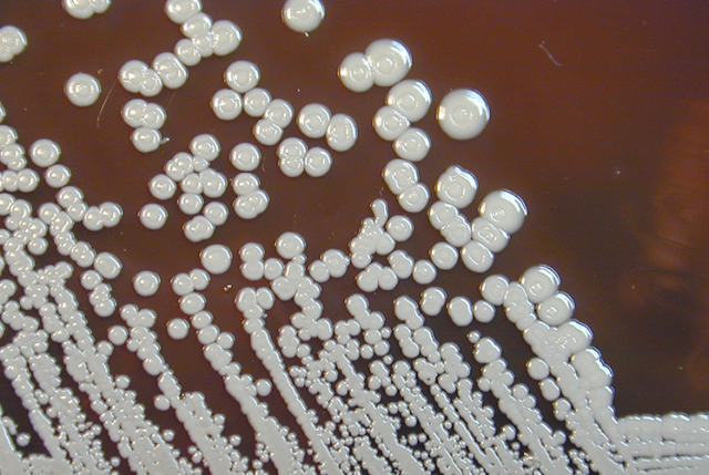 Burkholderia pseudomallei on Blood Agar - B.pseudomalleion Blood Agar