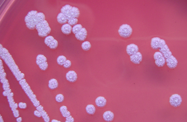 Burkholderia pseudomallei - Burkholderia pseudomalleion Ashdown’s medium(image source: Gavin Koh ref-2)