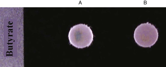 Butyrate disk test - Butyrate disk test A, Positive test. B. Negative test