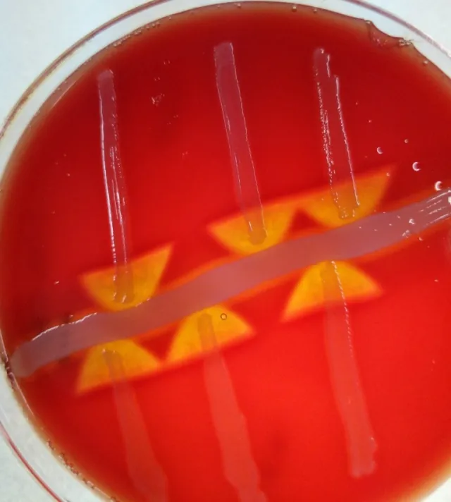 CAMP Test - CAMP Test Positive (arrowhead increased zone of hemolysis)