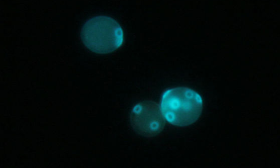 Calcofluor white stain - Fluorescent staining of yeast with Calcofluor white stainImage source:Kunetskiy