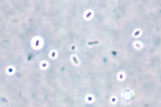 Capsule stain - Capsule staining by India ink method (at 1000x magnification)