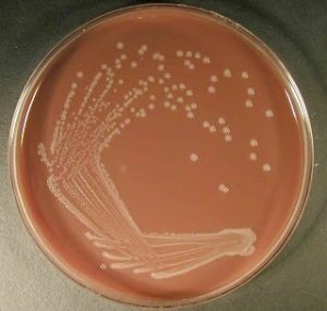 Haemophilus influenzae on chocolate agar - Haemophilus influenzaeon chocolate agar