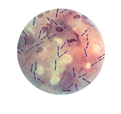 Boxcar shaped C. perfringens - Boxcar shapedC. perfringens
