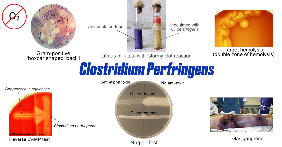 Common properties of Clostridium perfringens - Major characteristics ofClostridium perfringens