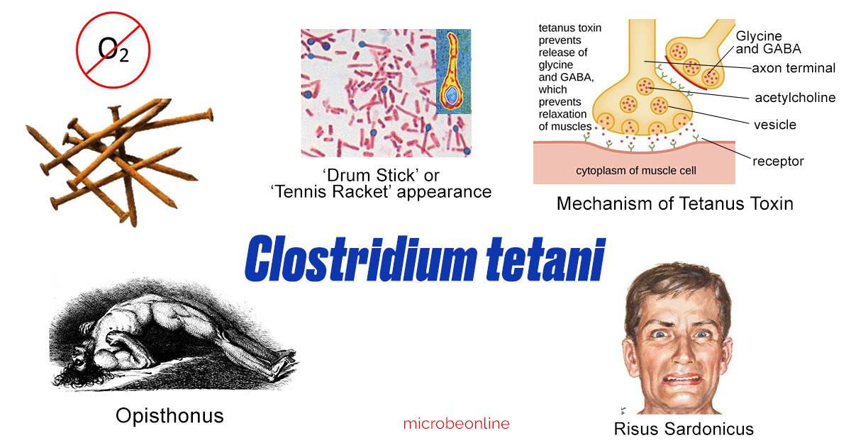Clostridium tetani cover image - Major characteristics ofClostridiumtetani