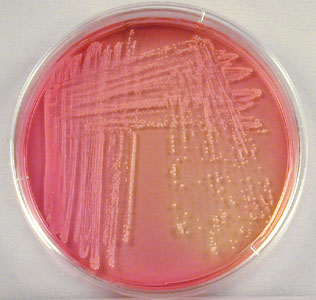 Staphylococcus saprophyticus Growing on Mannitol Salt Agar - Staphylococcus saprophyticusgrowing on Mannitol Salt Agar (Image source: Gary E. Kaiser)