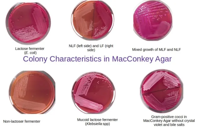 Colony characteristics in MacConkey Agar