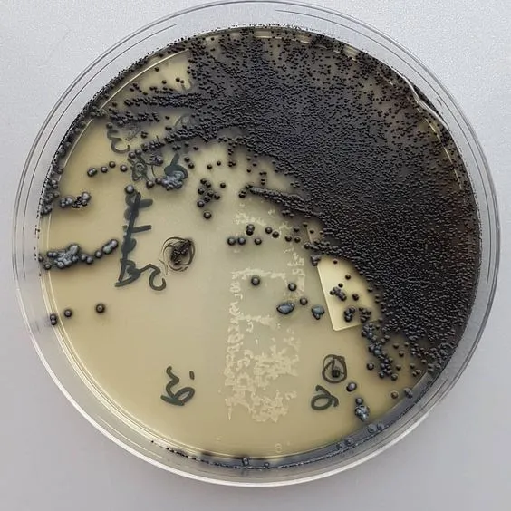  - Corynebacterium diphtheriaein Tinsdale Agar mediumLook for black colonies with brown halo (Image source:  Anonymous)