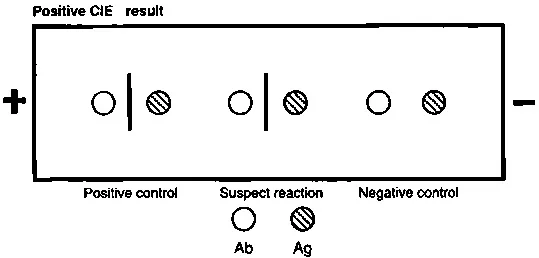 Counterimmunoelectrophoresis