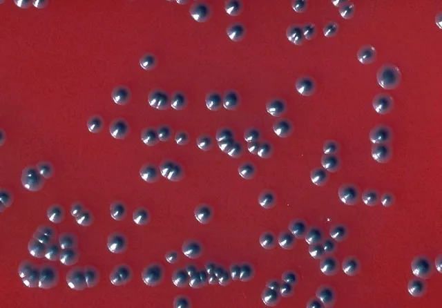 Colonies of Corynebacterium diphtheriae biotype gravis in tellurite blood agar - Colonies ofCorynebacterium diphtheriaebiotype gravis in tellurite blood agar(Image source:CDC/ Dr. W.A. Clark )