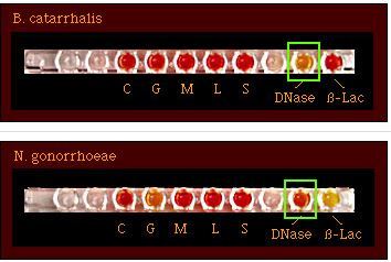 DNase Test Results - Fig:2: DNase Test: M. catarrhalis (+ve) and N.gonorrhoeae (-ve). When organisms produce DNase, an acidic end product is formed and the pH indicator changes from red (alkaline) to yellow (acid).