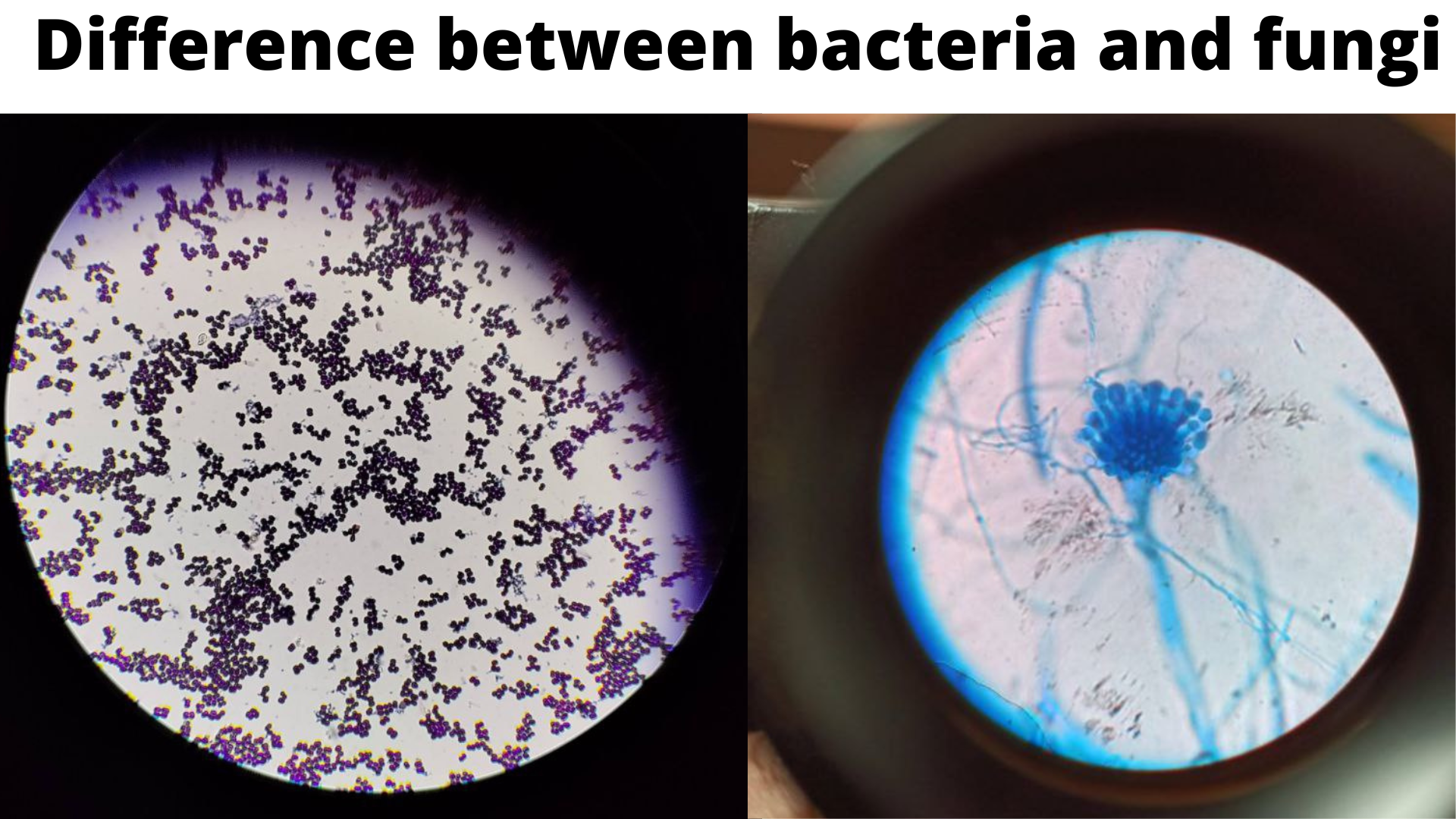 Difference between bacteria and fungi - Bacteria and fungi under microscope