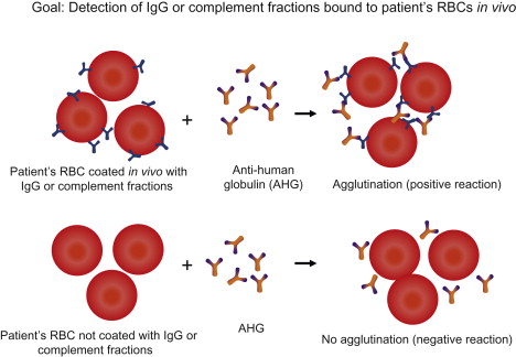 Direct Coombs Test - Direct Coombs Test (Source)