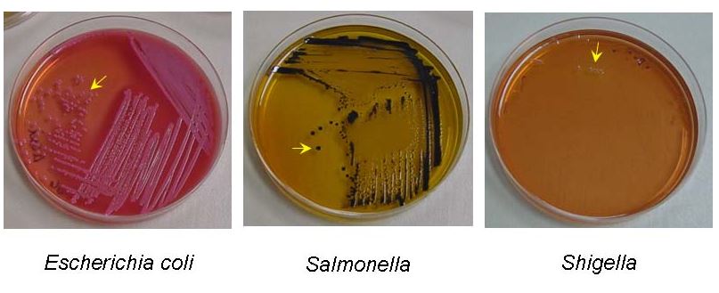 E coli Shigella Salmonella - Colony morphology ofE.coli, SalmonellaandShigellain Salmonella-Shigella Agar