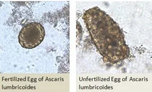 Egg of Ascaris in Wet Mount - Egg ofAscarisin wet mount