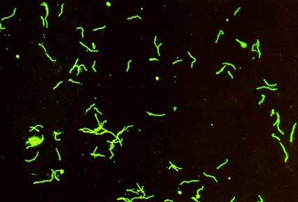 Treponema pallidum in FTA-ABS Test Results - PositiveFTA-Abs testresult showingTreponema pallidumcoated with host anti-treponemal antibodies.