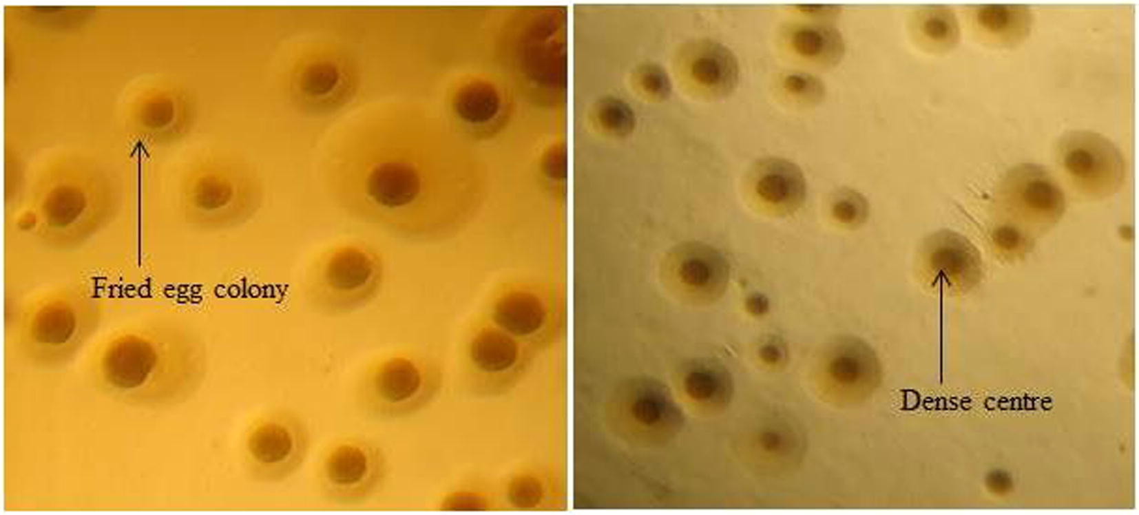 Fried egg colonies of Mycoplasma (cell wall-deficient bacteria) - Fried egg colonies ofMycoplasma(source)