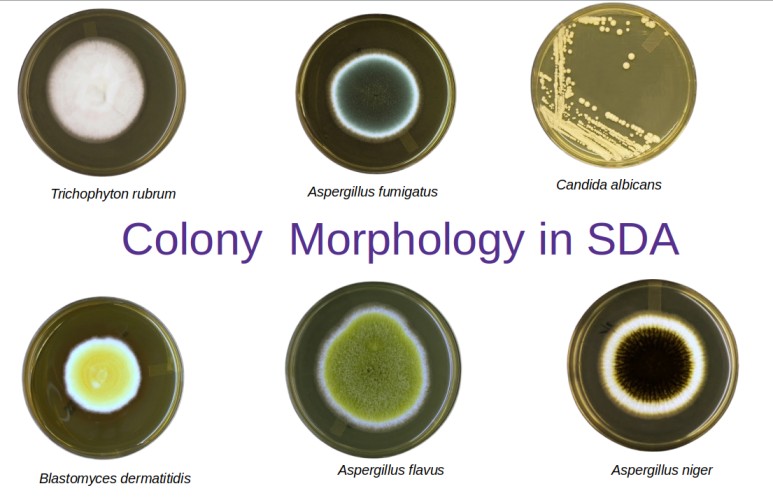 Various fungal colonies in SDA agar - Fungal colonies (front-side) on Sabourad Dextrose Agar