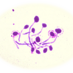 Candida albicans: Germ Tube Positive  - Candida albicans: Germ Tube Positive