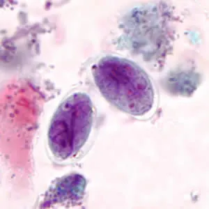 Cyst of Giardia lamblia (trichrome staining) - Cyst ofGiardia lamblia