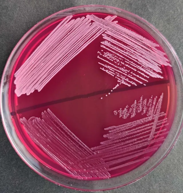  - Light pink, small colonies ofS. aureus(above) and dark pink-red, minute colonies ofEnterococcus(below) on MacConkey agar without bile salts and crystal violet.