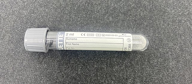 Gray blood collection tube - Gray Vacutainer