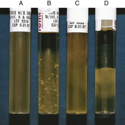 Growth Characteristics of Various Bacteria in tholgycollate broth - Growth characteristics of various bacteria in thioglycollate broth