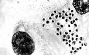 H capsulatum in Giemsa stained preparation  - H. capsulatumin Giemsa stained preparation