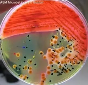 Hektoen enteric agar colonies - Stool culture on Hektoen enteric agar: mixed flora including Escherichia coli (red arrow), Salmonella (blue arrow), and Proteus vulgaris (yellow arrow).