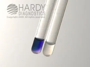 Hippurate hydrolysis test-Left (positive tube), Right (Negative tube) - Hippurate hydrolysis test-Left (positive tube), Right (Negative tube)