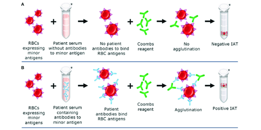 - Indirect antiglobulin test (Indirect Coombs Test)source