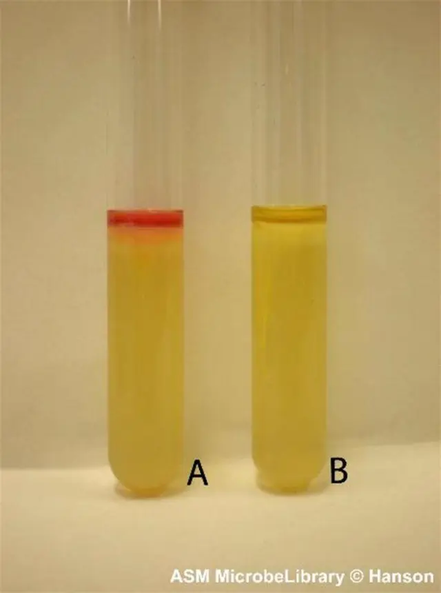 Result of the indole test using sulfur-indole-motility medium. A-positive, B-negative  - Result of the indole test using sulfur-indole-motility medium. The positive indole result is given byEscherichia coli(left)