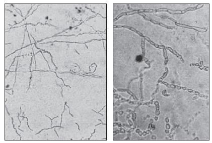 KOH Mount - Image 1:Left: Fungal hyphae in a (KOH) preparation of skin scales as seen with the 10x objective. Right: Hyphae and arthroconidia as seen with the 40x objective.(Image source-Reference-1)