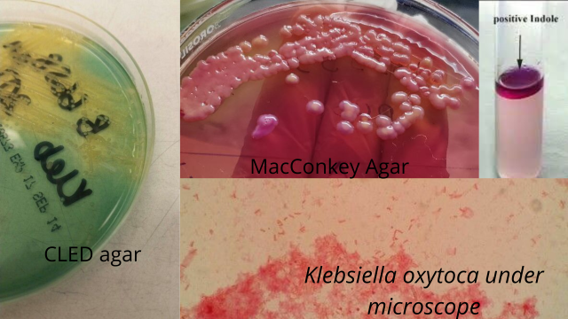 Distinguishing properties of Klebsiella oxytoca - Some distinguishing properties ofKlebsiella oxytoca