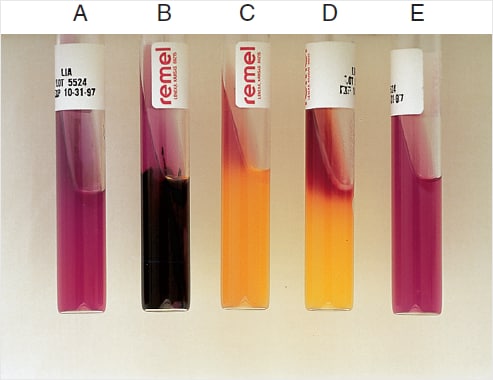 Possible results of LIA testing - A: Alkaline slant and alkaline butt (K/K)B: Alkaline slant/alkaline butt, H2S positive (K/K, H2S)C: Alkaline slant/acid butt (K/A)D: Red slant/acid butt (R/A)E: Uninoculated tube