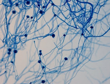 LPCB - Aspergillus flavuson LPCBImage source:Yuri