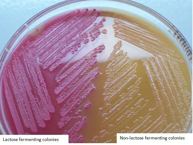 LF and NLF colonies in MacConkey Agar - LF and NLF colonies in MacConkey Agar