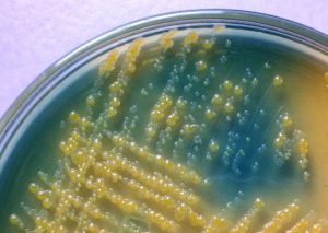 Lactose fermenting (Yellow colonies) and Lactose Non fermenting colonies in CLED - Lactose fermenting (yellow colonies) and Lactose Non-fermenting colonies in CLED