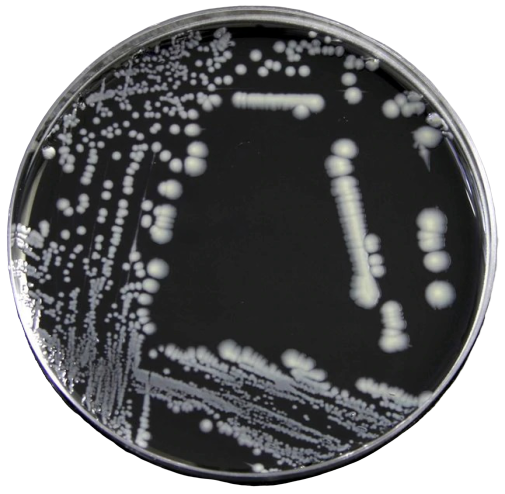 Legionella pneumophila colonies in BCYE agar - Legionella pneumophilacolonies in BCYE agar(Image source: Thermofischer)