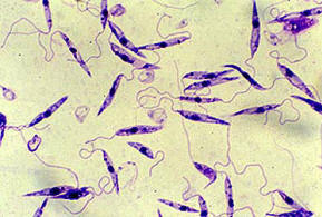 Promastigote form of Leishmania - Promastigote form of Leishmania