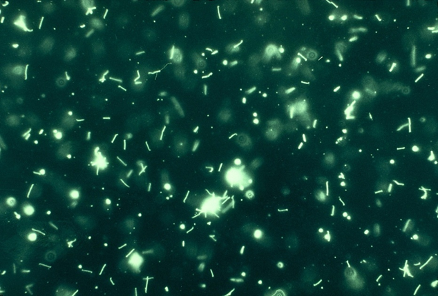 - Leptospiral microscopic agglutination test with live antigen using dark field microscopy