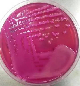 Mixed growth of mucoid Lactose fermenting colonies and NLF colonies in MacConkey Agar - Mixed growth of mucoid lactose fermenting colonies and NLF colonies in MacConkey agar