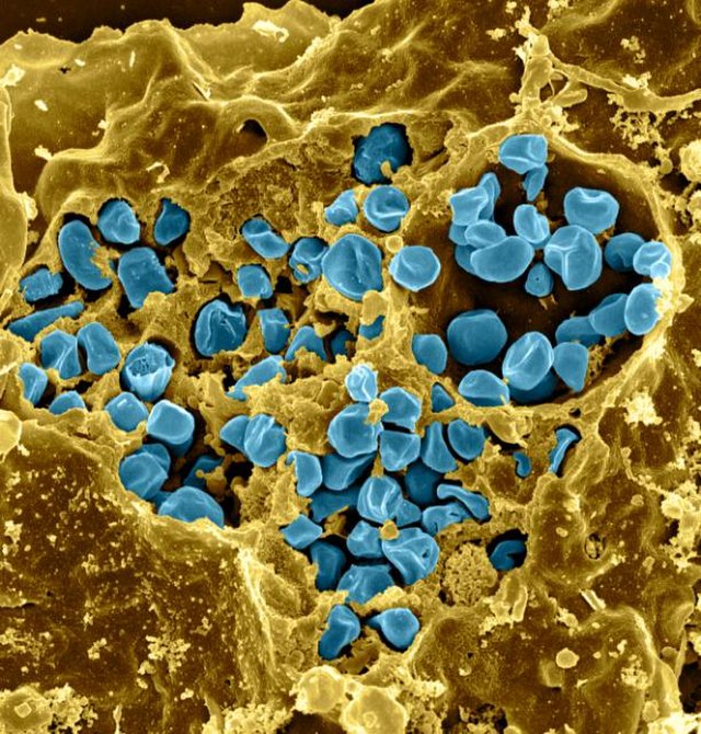 Macrophage infected with Francisella tularensis - Macrophage infected withFrancisella tularensis